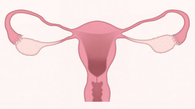 كيف تؤثر عملية استئصال الرحم على صحة المرأة؟